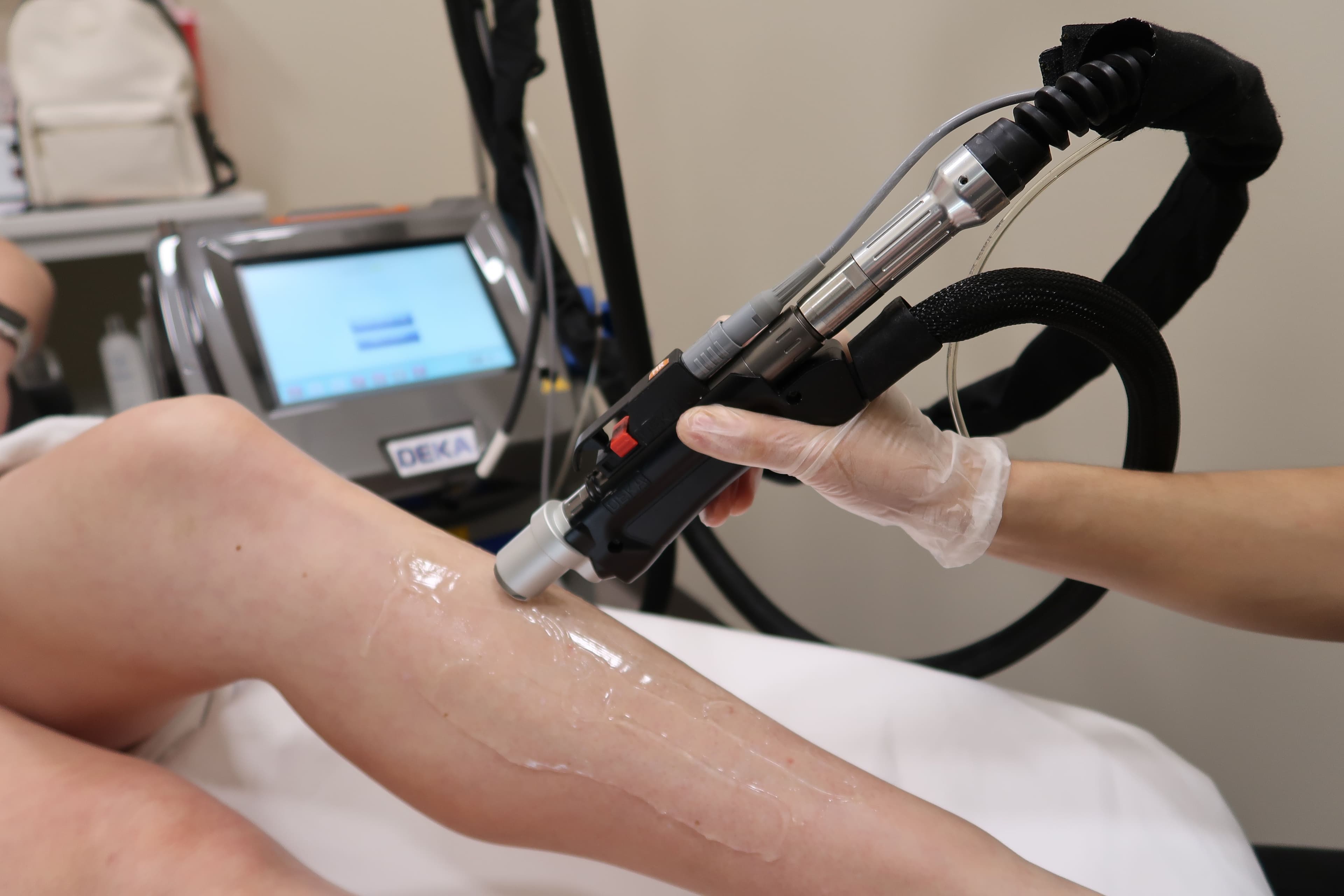 Laser Hair Removal for Women - Smooth, Confident Skin