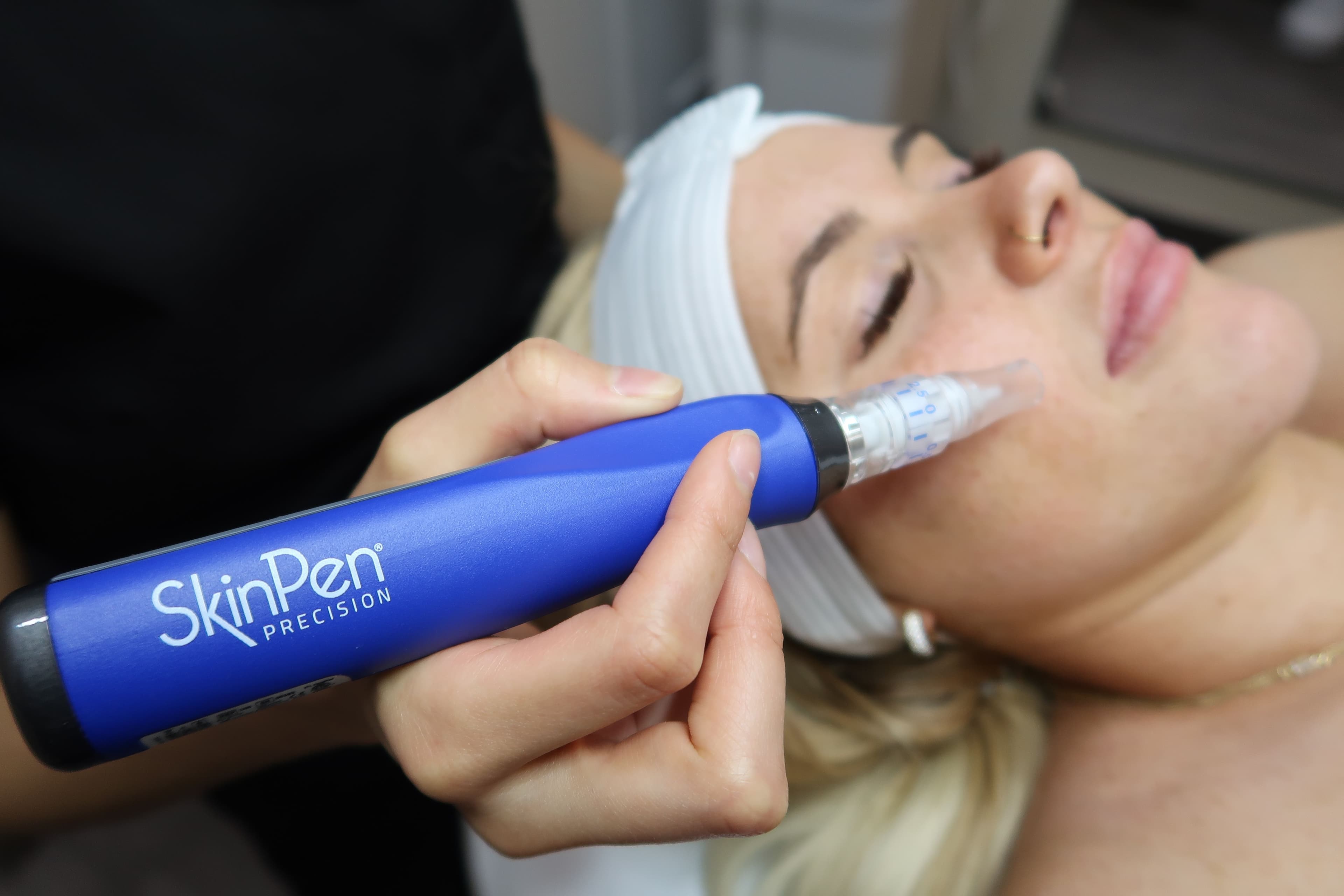 Microneedling SkinPen & RF for Radiant, Youthful Skin